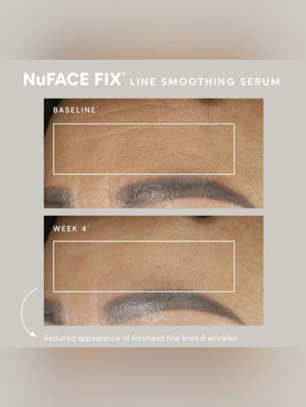 NuFace FIX Line Smoothing Serum - New In Box